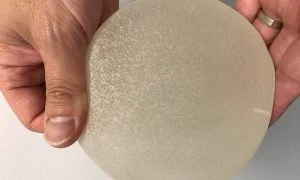 Update On Breast Implant Safety - 6